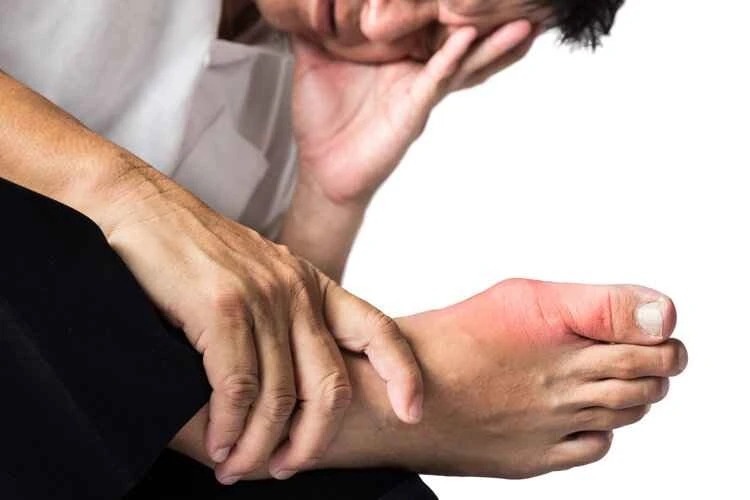 Is gout incurable? Don't despair! Follow these 3 principles and even high uric acid levels can be lowered.